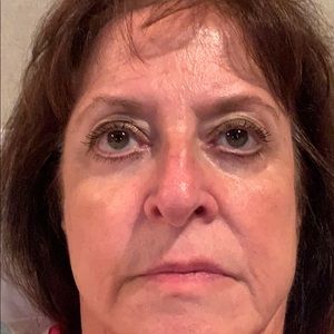 Meet your Posher, Pat